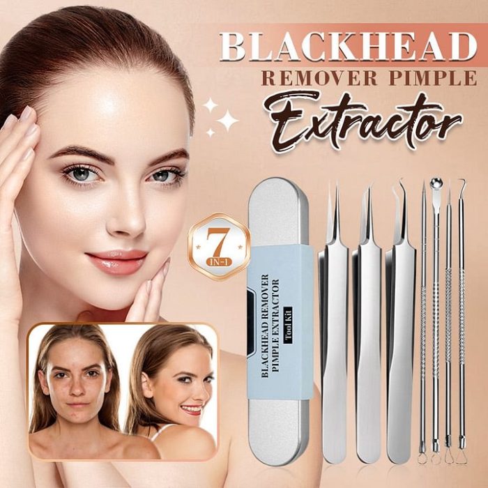 💓Last day discount💥Medical grade blackhead cell clip tool set - Image 1