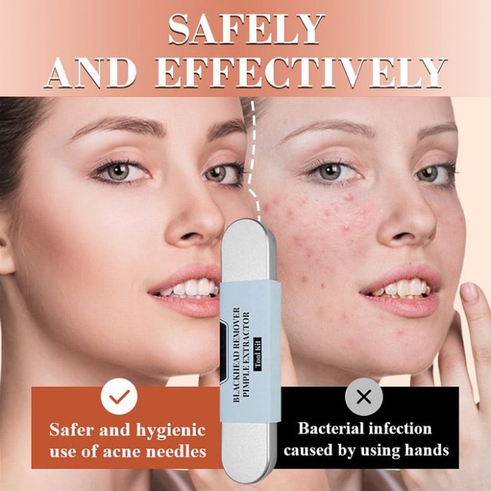 💓Last day discount💥Medical grade blackhead cell clip tool set - Image 2