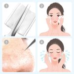 💓Last day discount💥Medical grade blackhead cell clip tool set - Image 8